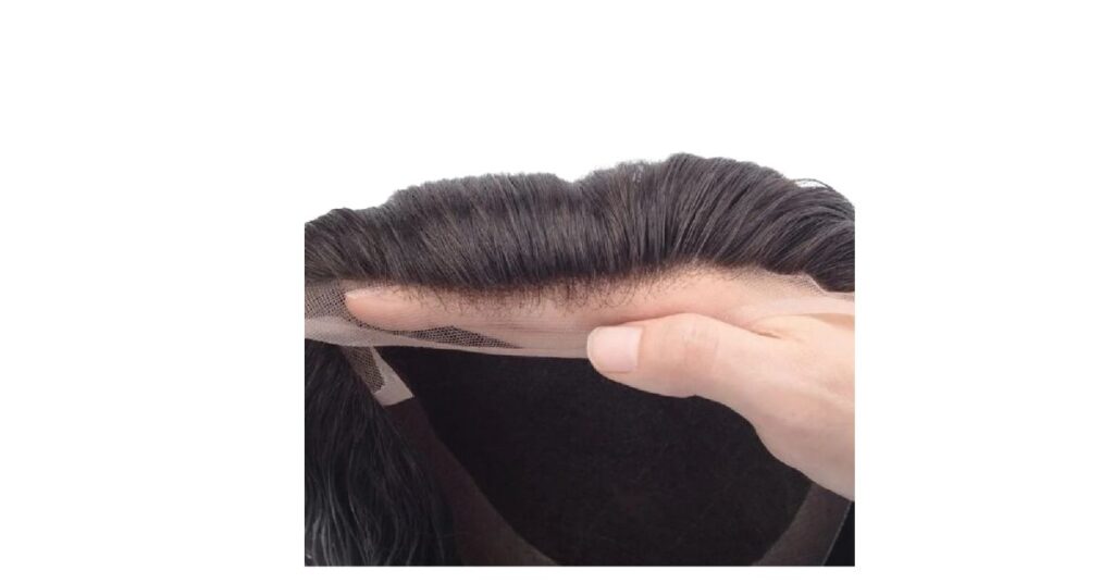 hairline solutions for women and men